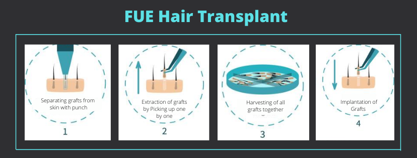 FUE Hair Transplant in Mumbai